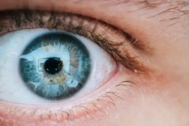 Close-up of an eye with lashes and eyelid margin