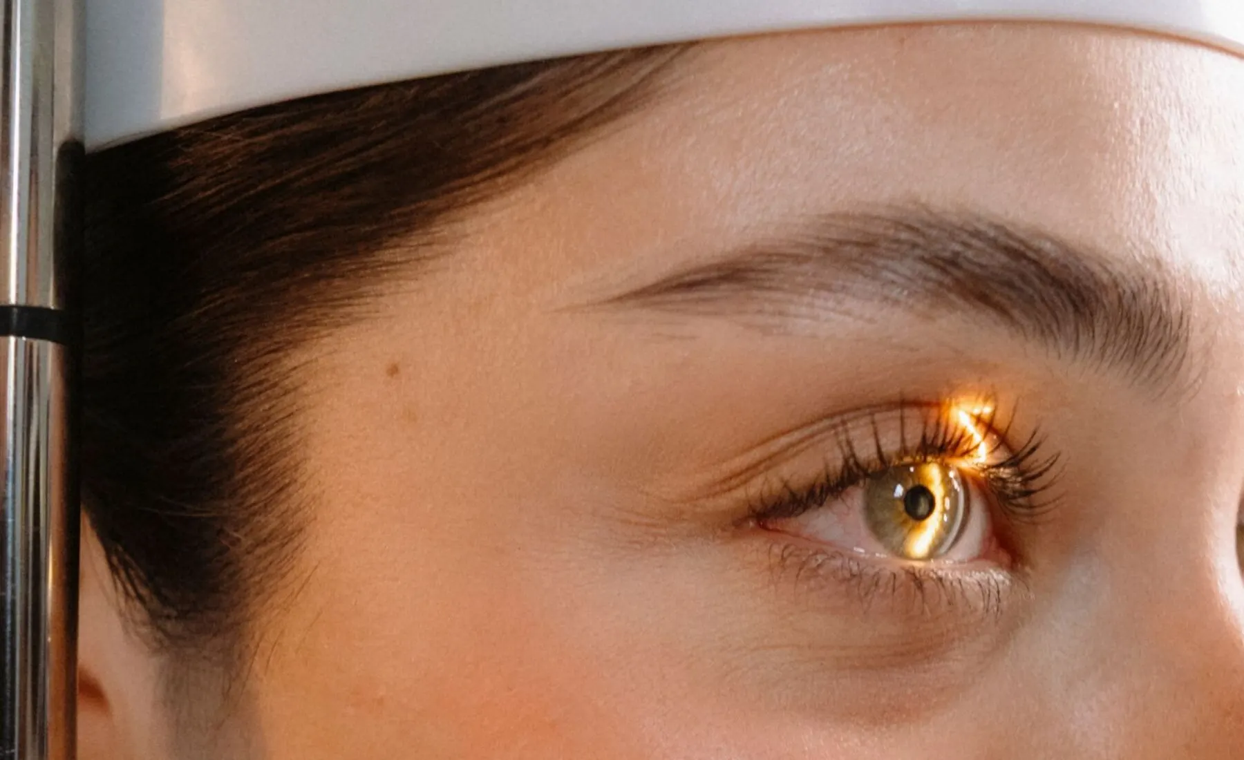 Close-up of an eye lit by a slit lamp during an urgent examination