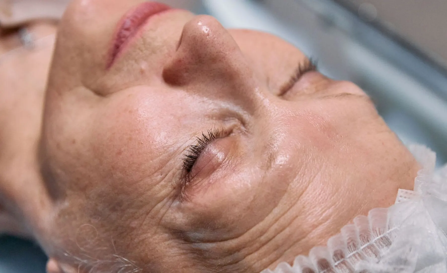 Patient resting with eyes closed during a calm clinical eye procedure