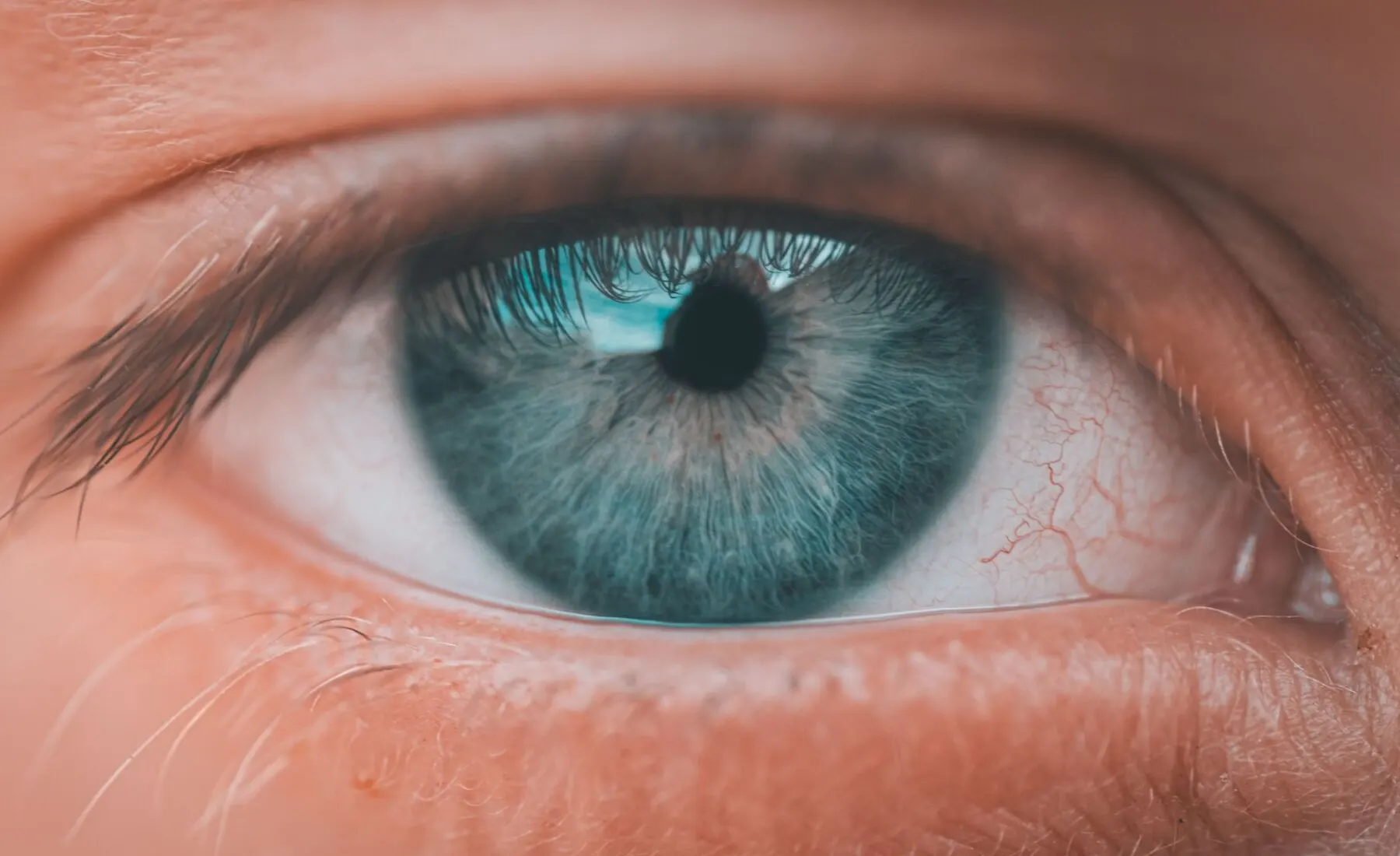 Close-up of an eye showing the eyelid margin and lashes